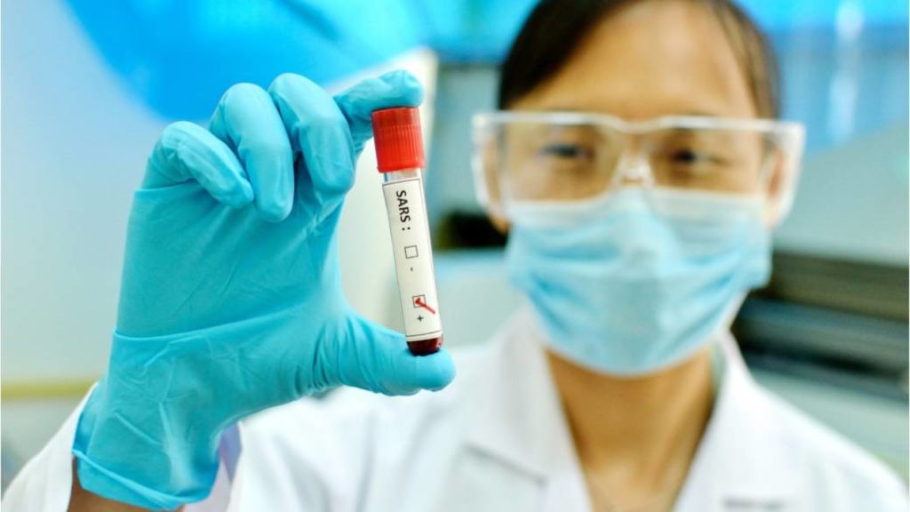 Canada to screen central China travelers for virus at 3 airports – Global News