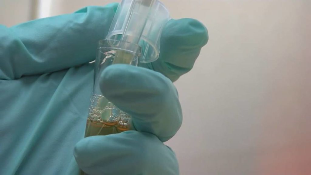 Coronavirus cases in Alberta and B.C. are linked. What does that mean for further spread? – Global News