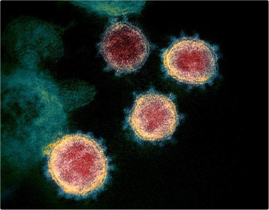 Bioinformatics identifies key genes and cellular pathways in COVID-19 – News-Medical.Net