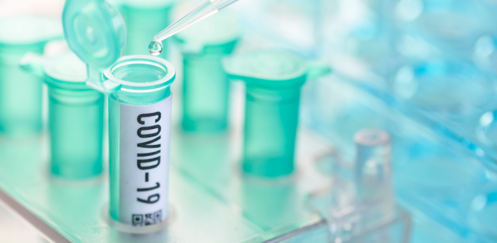 UK study finds new Covid-19 rapid test that gives result within 90 minutes – Deccan Herald