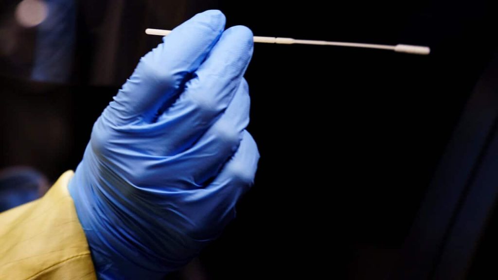 What you need to know about COVID-19 in Ottawa on Monday, Dec. 28 – CBC.ca