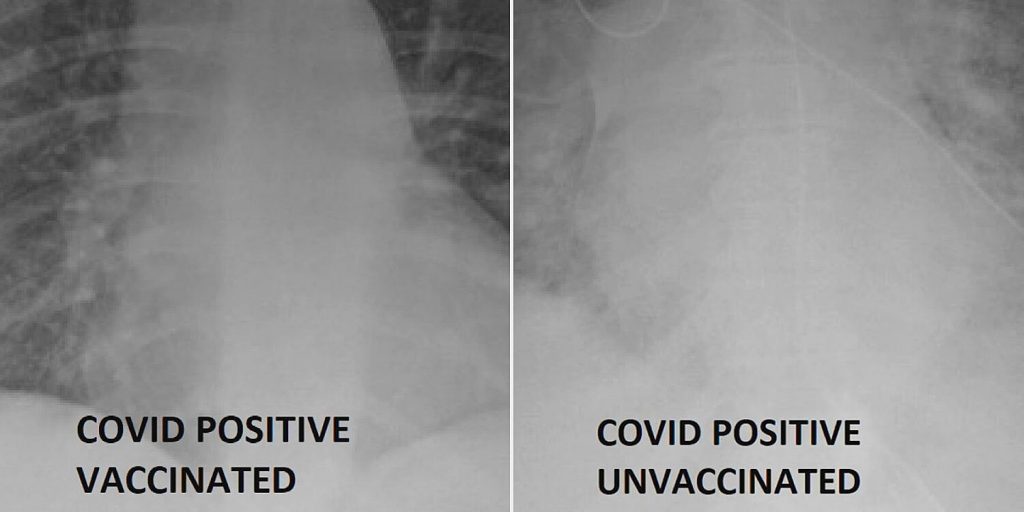 Pace of Rural Vaccinations Increases in 19 States – Flipboard