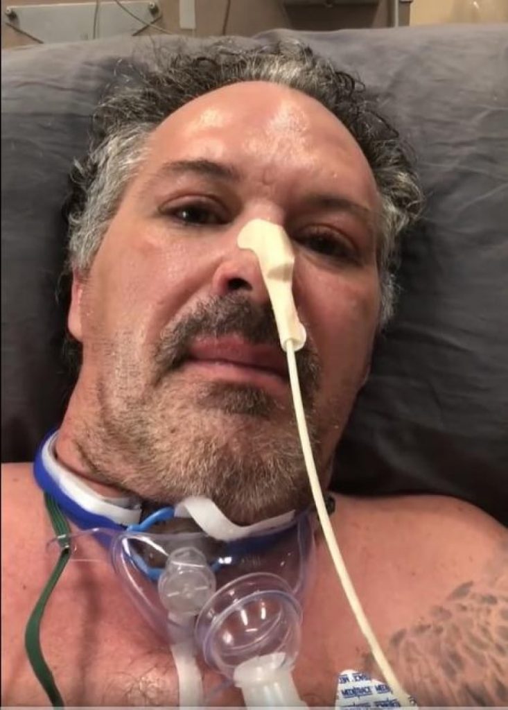 Delirium 'incredibly common' among patients in ICU, Alberta doctor says – CBC.ca