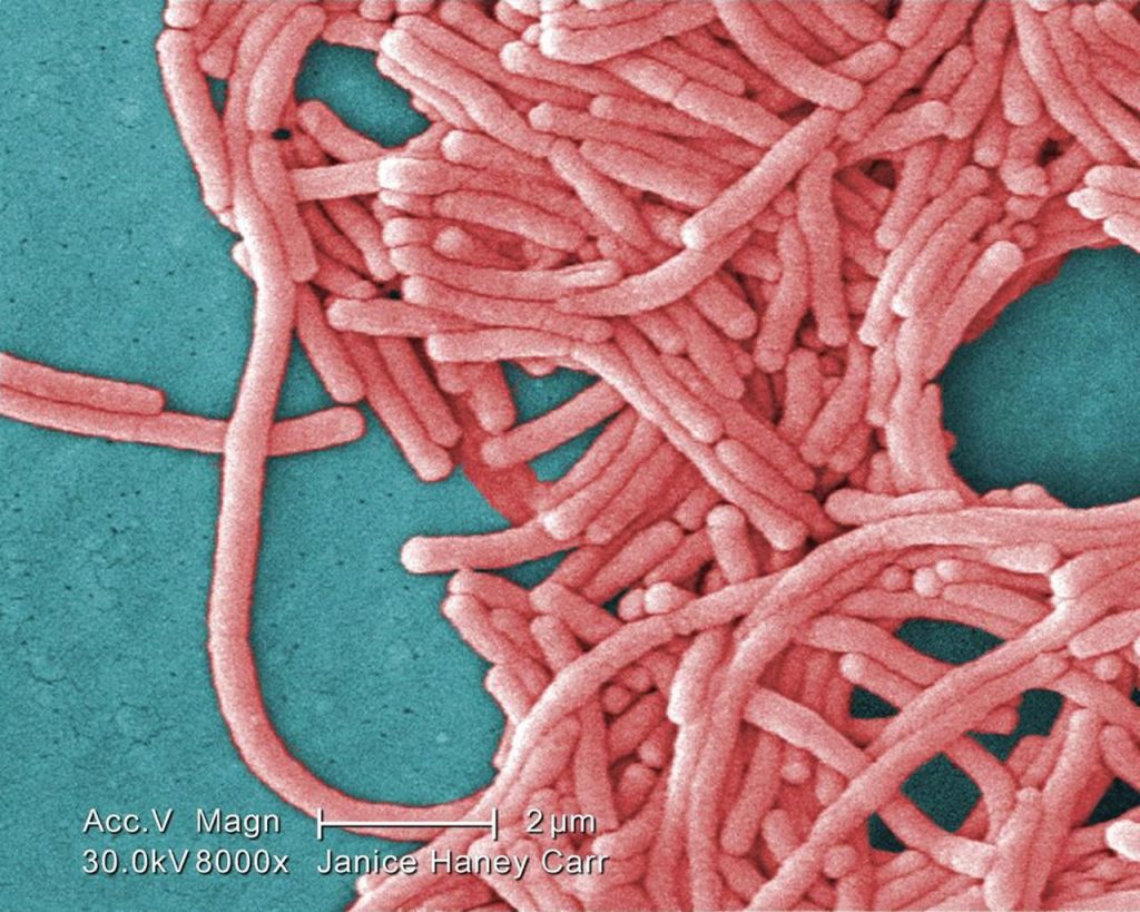 Investigation fails to find source of legionnaires' disease outbreak in New Brunswick – Toronto Star