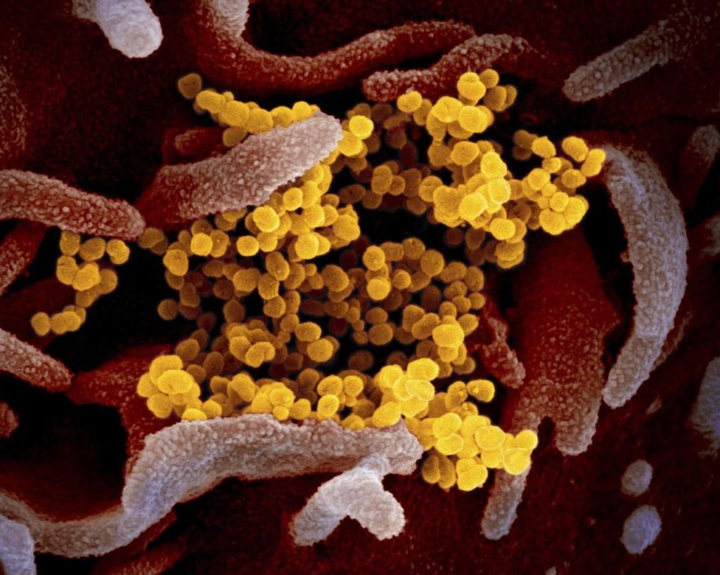 Yukon reports 32 new cases of COVID-19, no new deaths – Toronto Star