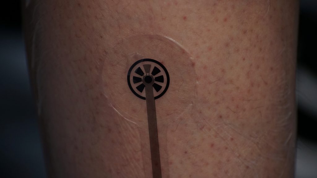 Singapore tests out ‘smart bandage’ for remote recovery