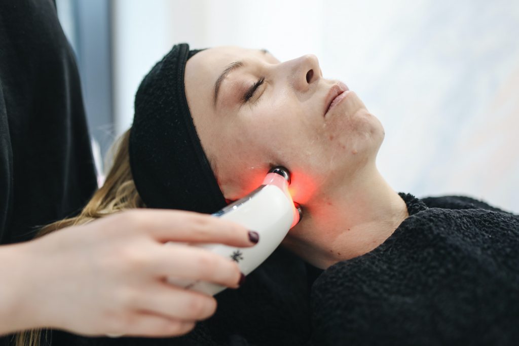 Winter Is the Best Time for Laser Acne Treatments