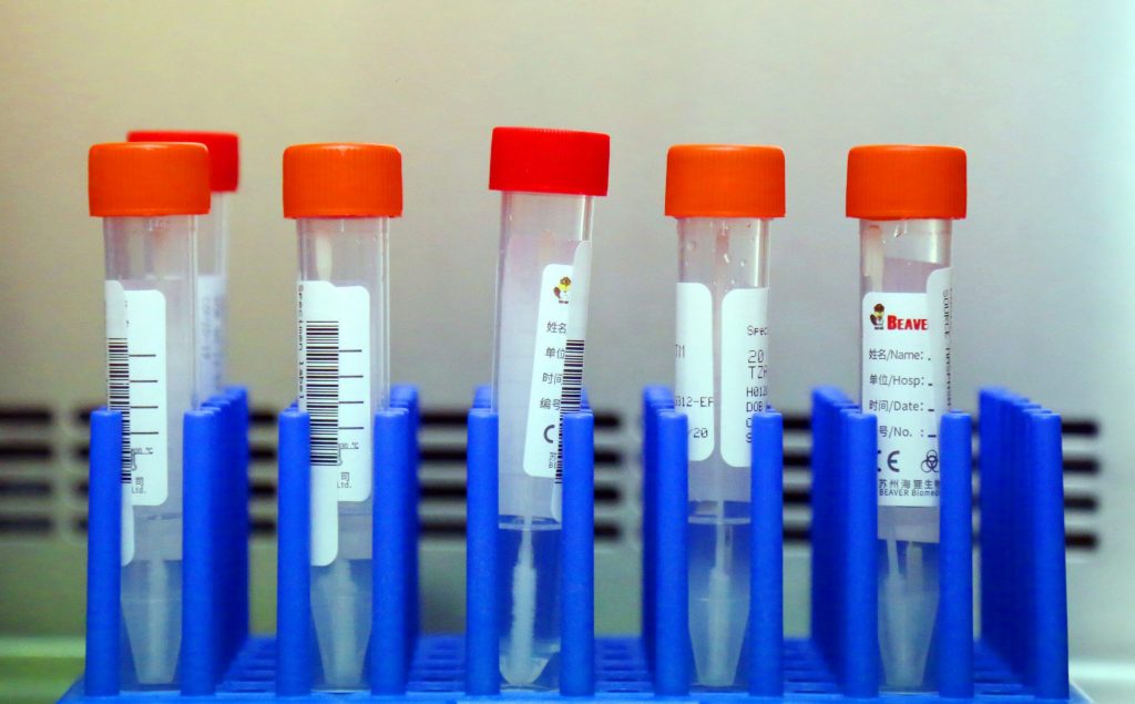 COVID-19 outbreak at Owen Sound hospital over; 11 other outbreaks continue – Shoreline Beacon