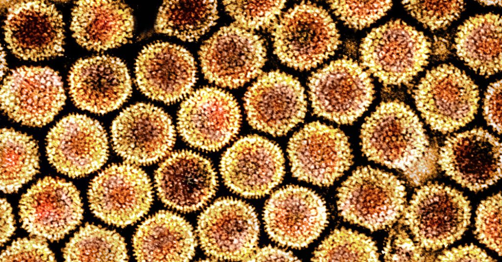 What Scientists Know About the Unusual Hepatitis Cases in Children – The New York Times