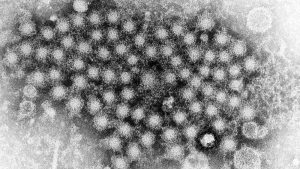 Unexplained hepatitis cases rise to 348 worldwide as WHO looks into role of COVID – Euronews