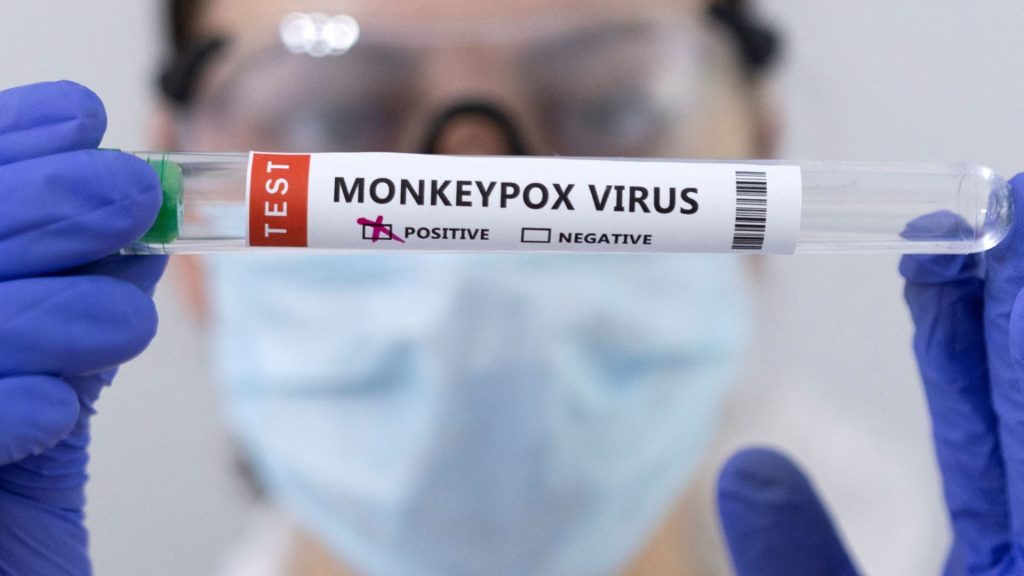 How to protect yourself against monkeypox and what to do if you catch it – CNBC