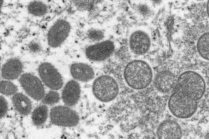 Canada’s first two monkeypox cases confirmed in Quebec, others under investigation
