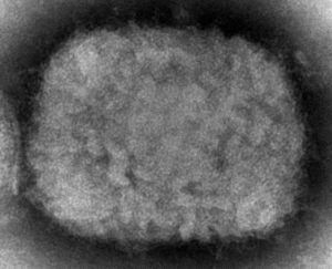 Canada considering smallpox vaccine for monkeypox cases, says Dr. Theresa Tam