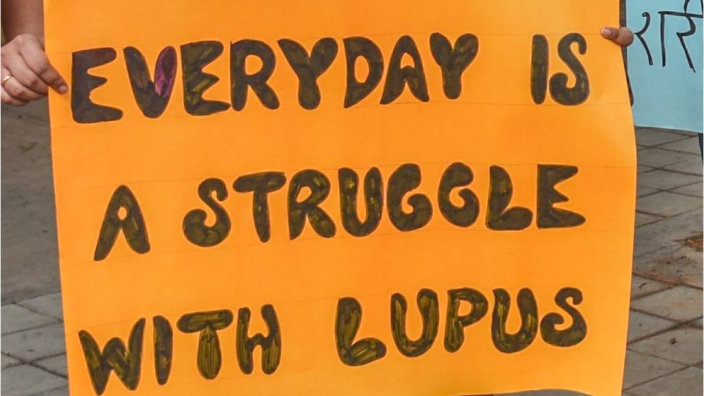 Lupus affects one in 1000 Indians – Deccan Herald