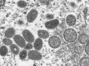 Cases of monkey pox identified in Portugal and America Cases of monkey pox identified in Portugal and America