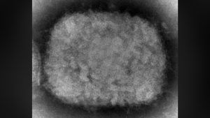 What is monkeypox, and is it in BC? | CTV News – CTV News Vancouver