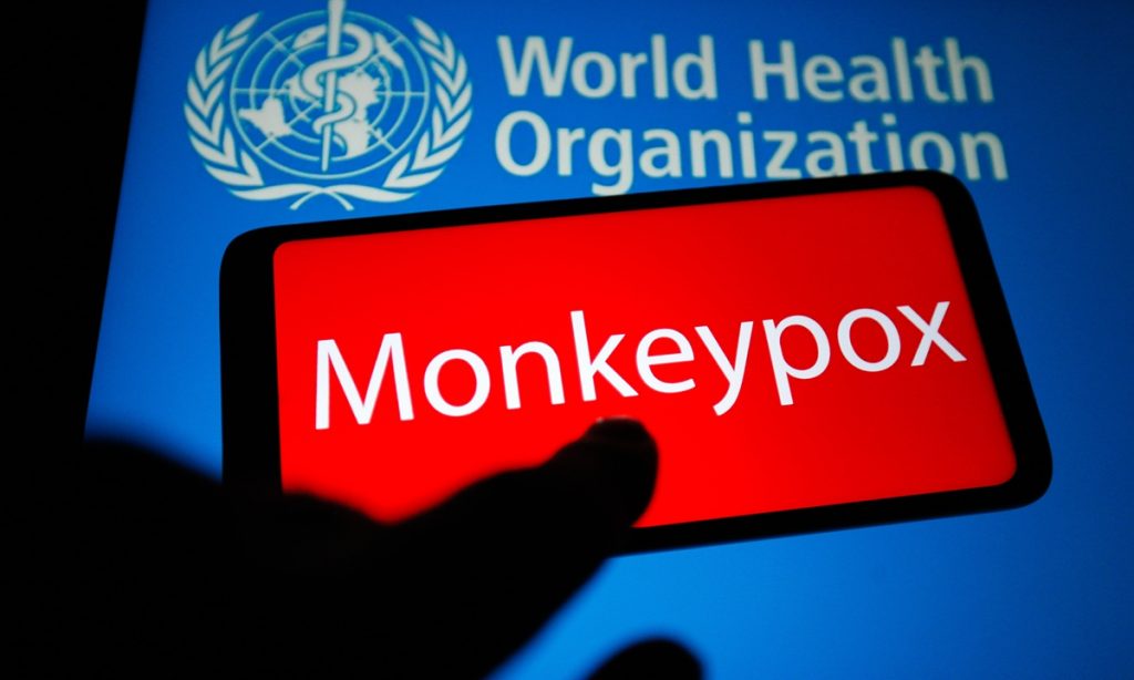 Fight monkeypox together: WHO – Global Times
