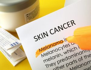 Melanoma rates are on the rise in Canada, study reveals – News-Medical.Net Melanoma rates are on the rise in Canada, study reveals – News-Medical.Net