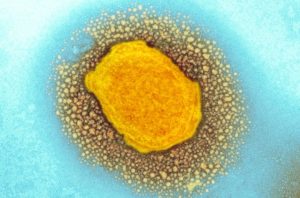 WHO warns of monkeypox risk to kids, pregnant people if spread continues – CBC News