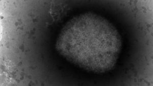 Canadian heading World Health Organization's fight against monkeypox – CP24 Toronto's Breaking News Canadian heading World Health Organization's fight against monkeypox – CP24 Toronto's Breaking News