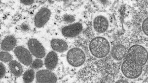 Monkeypox in Canada: Can I get the vaccine in BC? | CTV News – CTV News Vancouver
