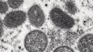 Toronto bathhouse workers among first to be offered monkeypox vaccine – CTV News Toronto