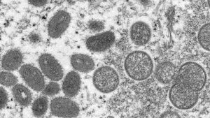 Monkeypox: UK reports 77 new cases – CTV News