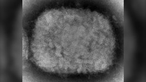 Monkeypox: US CDC says to 'practice enhanced precautions' – CTV News