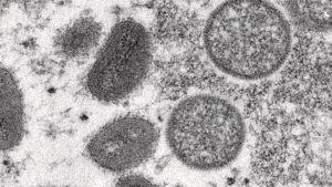Ottawa Public Health begins administering monkeypox vaccine to high priority individuals – CTV News Ottawa