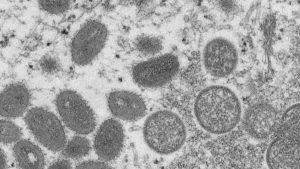 World Health Organization holding emergency session next week on monkeypox – CBC News World Health Organization holding emergency session next week on monkeypox – CBC News