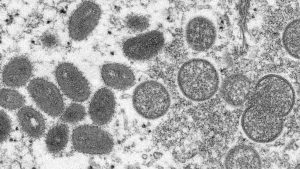 Island Health confirms one case of monkeypox on south Island – CHEK News