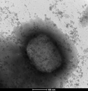 Quebec health officials say there are 248 confirmed monkeypox cases in the province