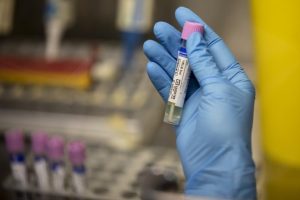 Public Health Ontario reports 230 monkeypox cases, up from 156 in last update – CHCH News