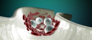 Get that Lymph Moving! – Office for Science and Society