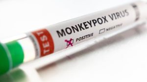 Brant County confirms 1st case of monkeypox – CBC.ca Brant County confirms 1st case of monkeypox – CBC.ca