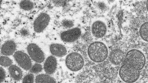 16 confirmed cases of monkeypox in Ottawa | CTV News – CTV News Ottawa