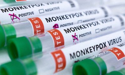 San Francisco declares State of Emergency due to a surge in monkeypox cases