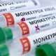 San Francisco declares State of Emergency due to a surge in monkeypox cases