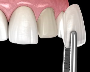 Cosmetic Dentistry