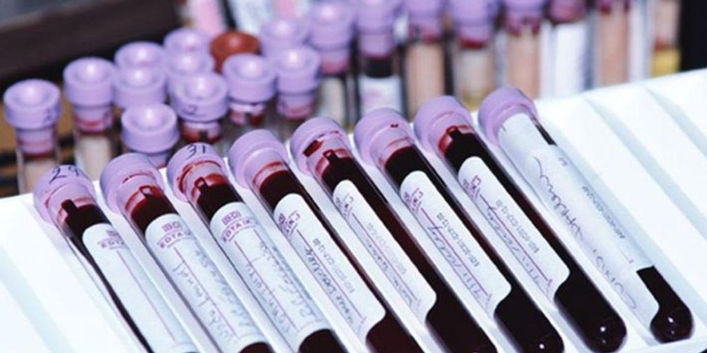 Blood Test Shows Promise at Catching Cancers Early – HealthDay News