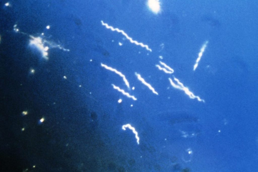 Researchers identify biomarkers that could help diagnose Lyme disease