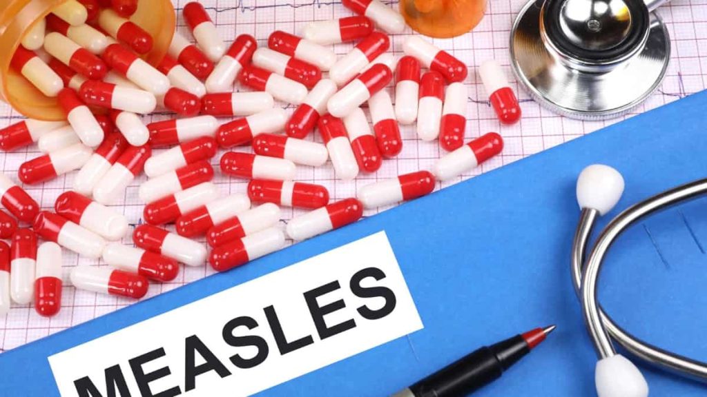 Risk of major measles outbreak in London, warns UK Health Security Agency