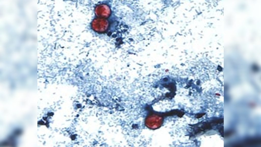 BCCDC warns of increasing Cyclospora cases involving food – CHEK News