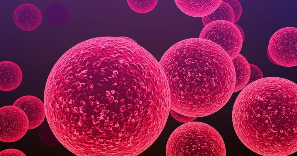 What is invasive group A strep? Deadly flesh-eating infection hits record numbers in Ontario and Canada