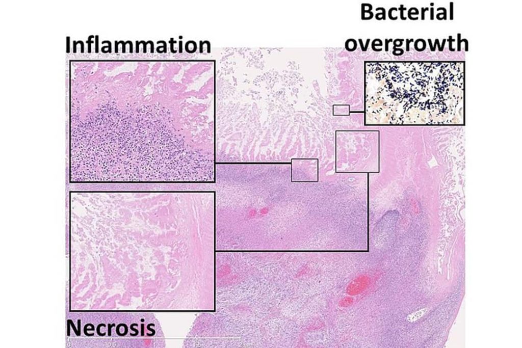 How sugar molecules from breast milk protect the lining of the gut – Varsity