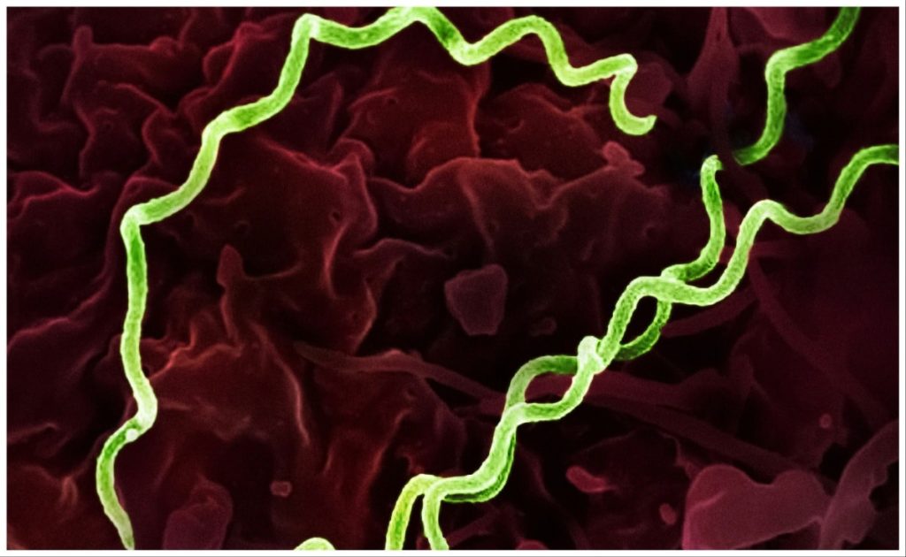 ”Syphilis Epidemic”: Cases Of Sexually Transmitted Disease Shoot Up In US