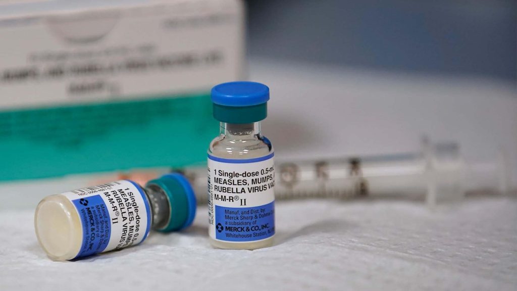 York Region Public Health investigating adult case of measles with 'unknown' infection source – CBC.ca