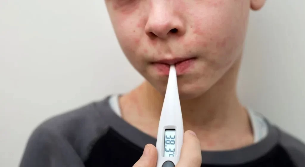 Public Health Agency urges everyone to get their measles vaccines – CJWW