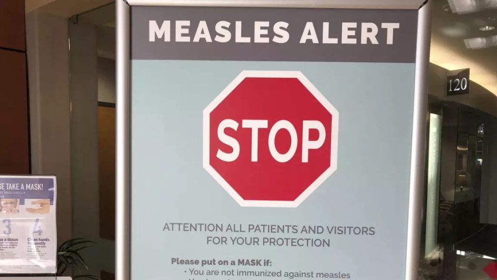 AHS confirms case of measles in Edmonton – CityNews Edmonton