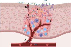 Oral microbiome and cancer: A closer look into the intricate interplays of the mouth’s hidden world – Medical Xpress